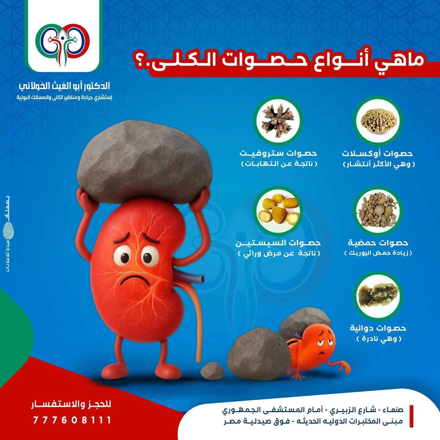 انواع الحصوات